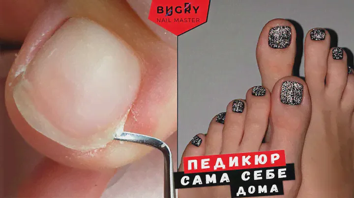 КАКИЕ ПРОБЛЕМЫ В ПЕДИКЮРЕ / САМА СЕБЕ #ТатьянаБугрий
