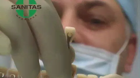 Санитас реставрация