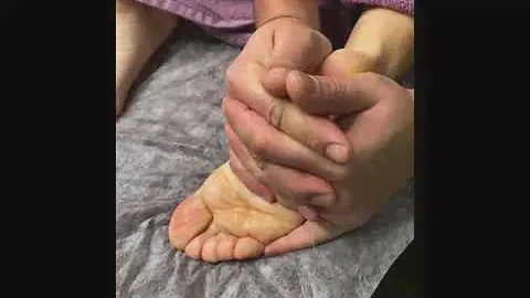 massage anti cellulite